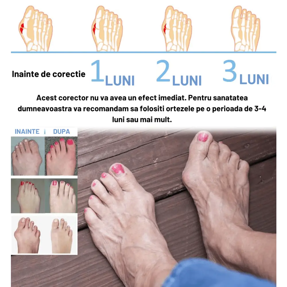 Vindecare Monturi cu orteza Gadgetry